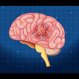 best neurology hospital in nagpur