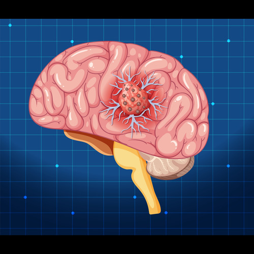 best neurology hospital in nagpur